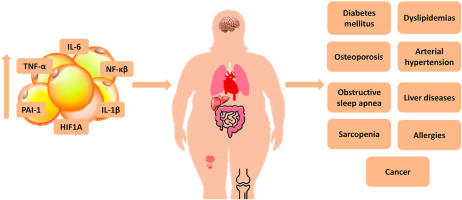 obesity_surgery_before_afte